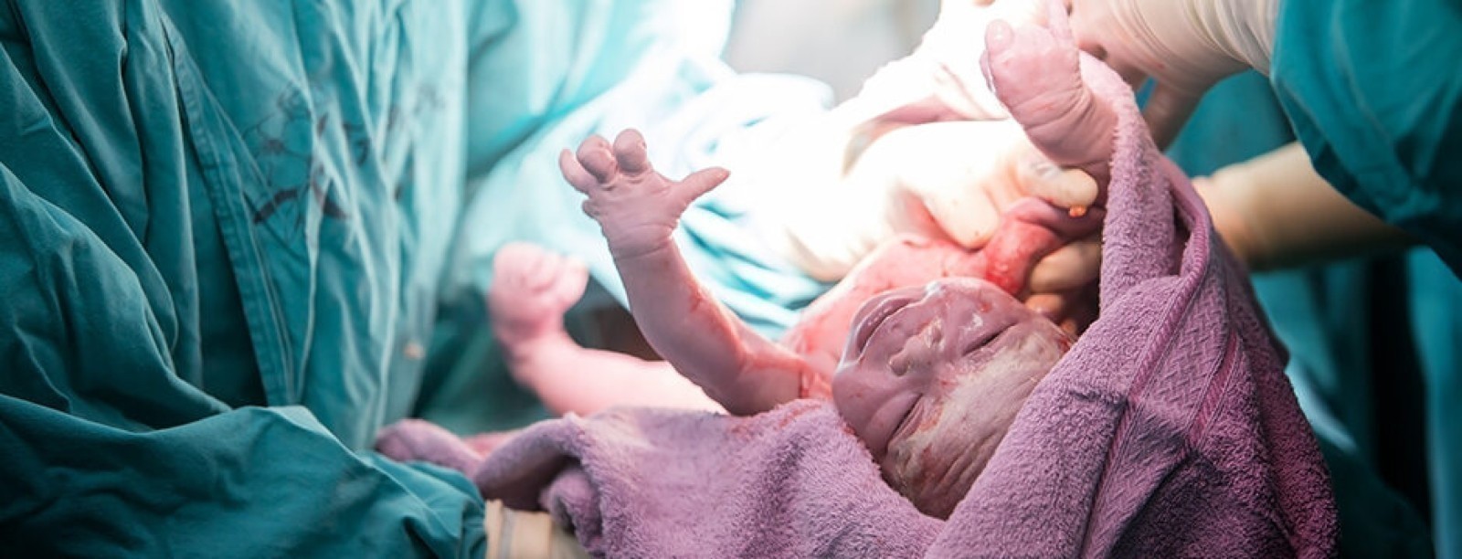 geburt-kaiserschnitt_1-1-940x360